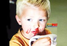 নাক দিয়ে রক্ত পড়া বন্ধ করার ঘরোয়া উপায়