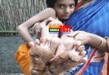 বিরল রোগে আক্রান্ত শিশু তাসনিম: কে বহন করবে চিকিৎসার ভার?