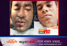 অস্ট্রেলিয়ায় আশ্রয় চাওয়া দুই বাংলাদেশি মুখ সেলাই করে আমরণ অনশন
