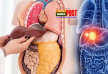 লিভার-সংক্রান্ত রোগের লক্ষণ