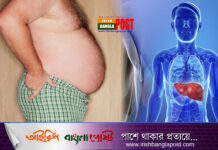 ফ্যাটি লিভার প্রতিরোধের ৫ উপায়