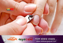 নখের পাশে চামড়া ওঠে কেন, করণীয় কী